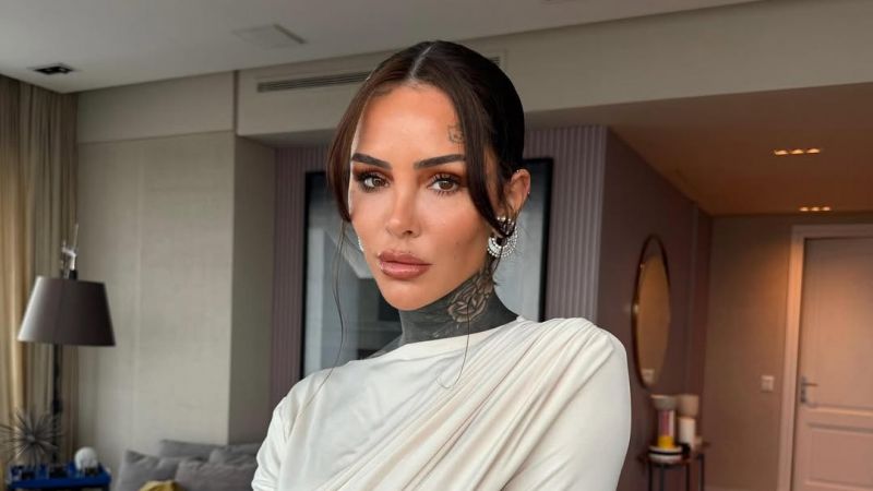Cande Tinelli sufrió un accidente y fue operada de urgencia
